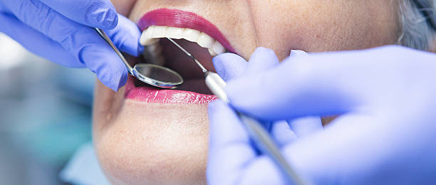 Best Emergency Wisdom Tooth Extraction in Glenpool, OK